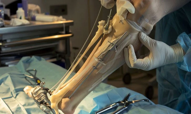 Knee Replacement Hospital in Faridabad